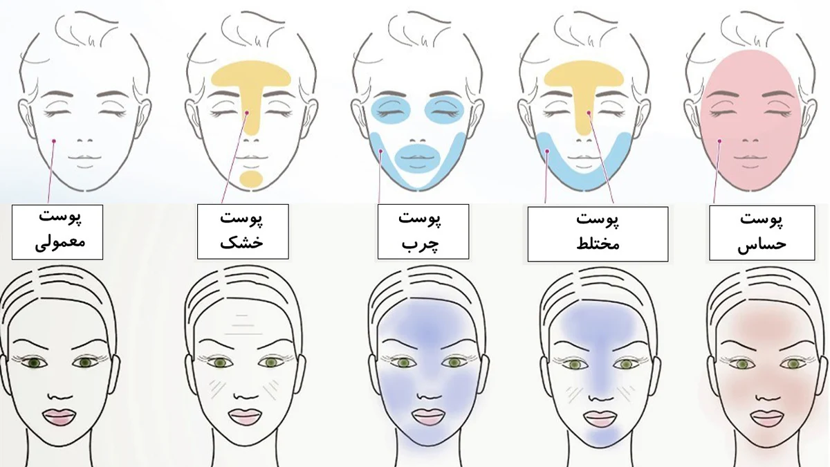 معرفی انواع پوست ها