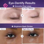 قبل و بعد استفاده از سرم لیفت دور چشم نامبوزین