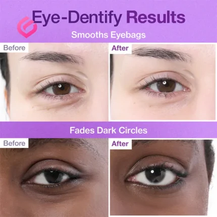 تاثیر قبل و بعد پچ زیر چشم نامبوزین شماره 9